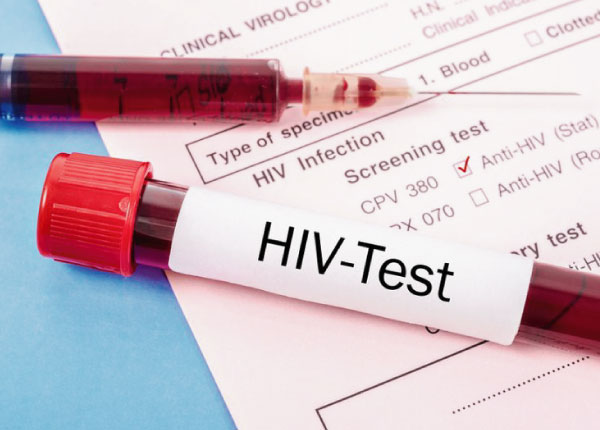 Thử máu là cách duy nhất kiểm tra HIV