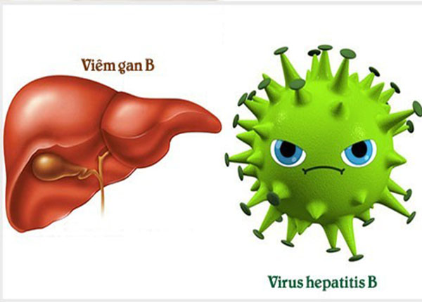 Điều gì sẽ xảy ra khi bạn bị mắc bệnh viêm gan B?